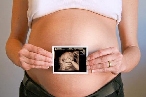 gravid kvinde holder skanningsbillede