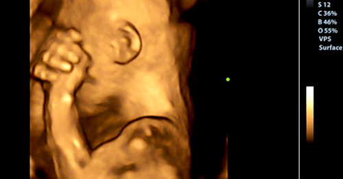Hvad Din Baby Føler, Når Du Græder Under Graviditet