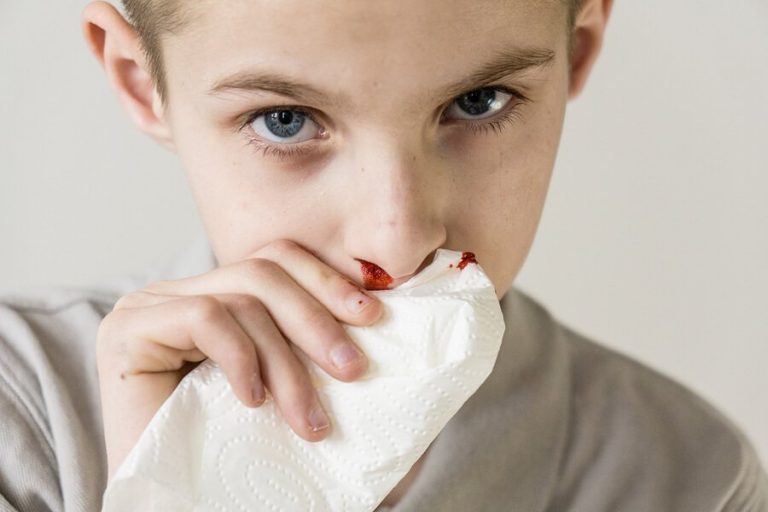 Næseblod hos børn: Årsager og behandling