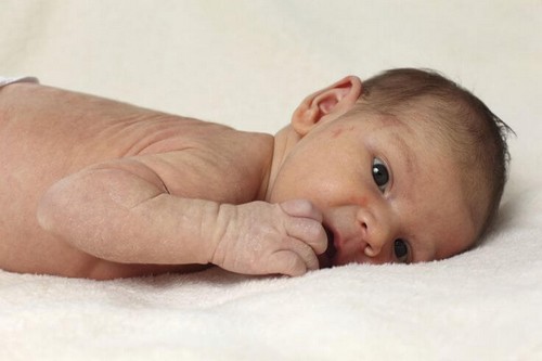 baby har udslæt på kroppen
