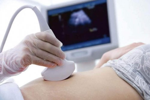 Gravid kvinde til ultralydsscanning - hvor lang tid varer en graviditet