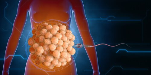 Sædcelle på vej ind i maven