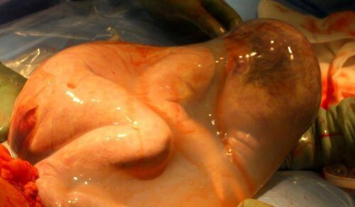 Baby tildækket