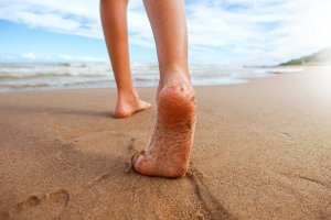 Hjulben hos børn og hvordan man korrigerer det