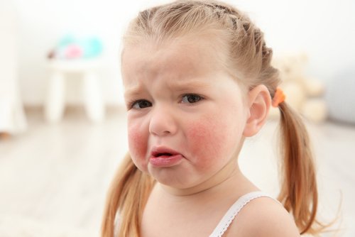 Lille pige med allergi