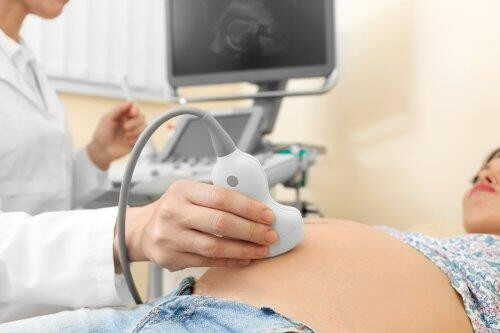 Gravid kvinde får foretaget en ultralydsscanning 