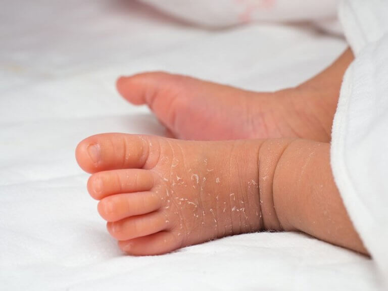 Hvordan skal pleje din nyfødtes hud