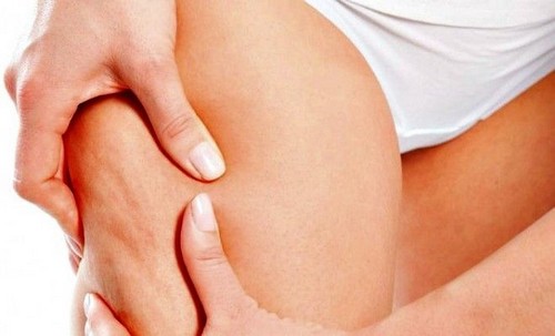 Appelsinhud efter fødslen