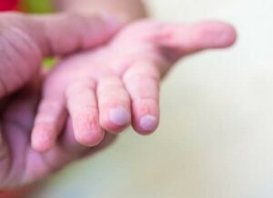 Vabler hos børn: Sådan behandler du dem