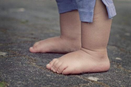Achondroplasi hos børn: Årsager og karakteristika