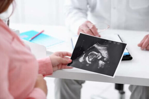 scanning af baby
