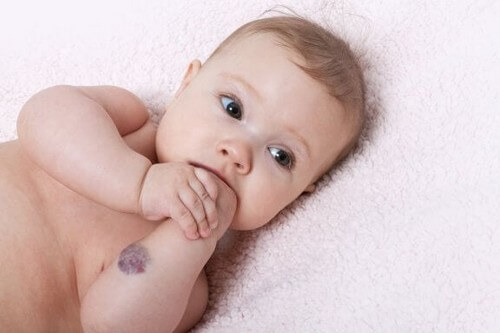 Almindelige kraniofaciale anomalier hos babyer