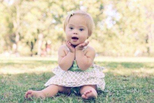 lille pige med Downs syndrom