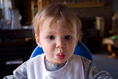 Tips til at skjule ar hos børn