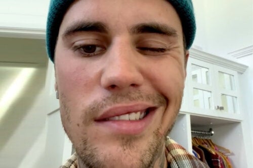 Ramsay Hunts Syndrom: Den tilstand, som Justin Bieber har