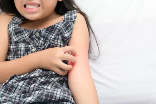 Dermatillomani hos børn: Hvad er det?