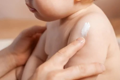 Babys hud smøres med creme