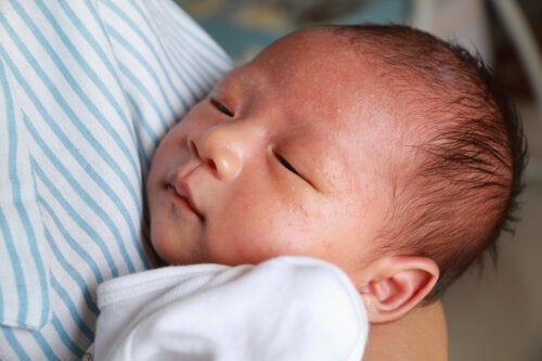 Mælkeallergi hos babyer: Hvad du bør vide