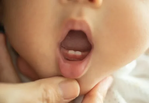 Baby med åben mund