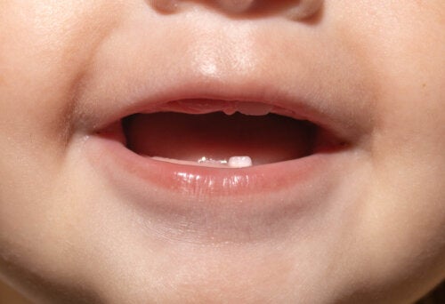 Dit barns første tandlægebesøg: Hvad du kan forvente