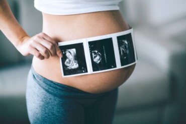 10 spørgsmål om ultralydsscanning under graviditet